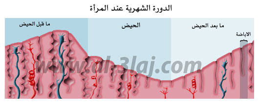 ما علاج تاخر الدورة الشهرية - علاج تاخر التبويض 1136 5