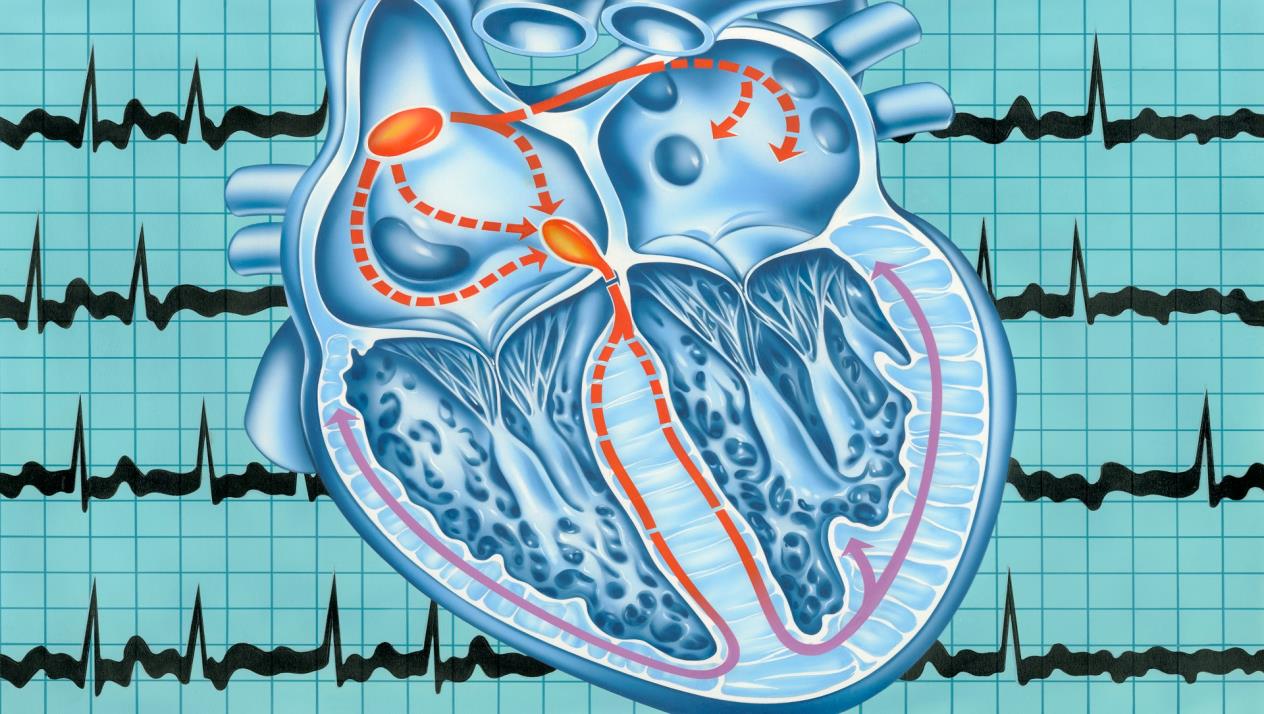 أعراض اضطراب نبضات القلب - اضطراب نبضات القلب 2699 3