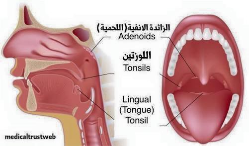 لحمية الانف عند الاطفال - عملية اللحمية مشكلة قصوي 1466 2