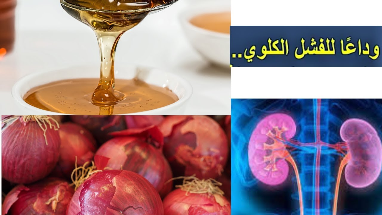 علاج الفشل الكلوي مجرب , وصفات لعلاج الفشل الكلوي بالاعشاب