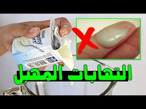 علاج حكة المهبل في البيت - حلول منزلية لمواجهة الهرش في منطقة المهبل 3997 3