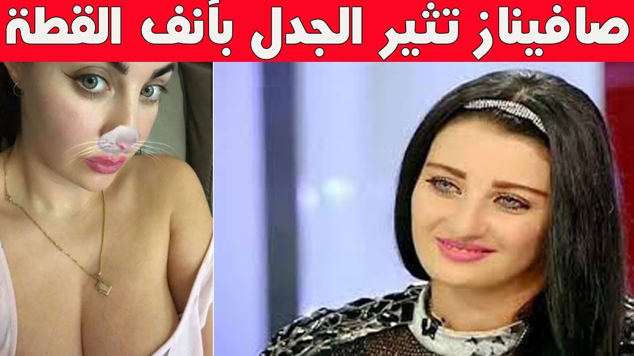 صور صافيناز قبل عملية التجميل - صور صفينار بعد التجميل 972 3