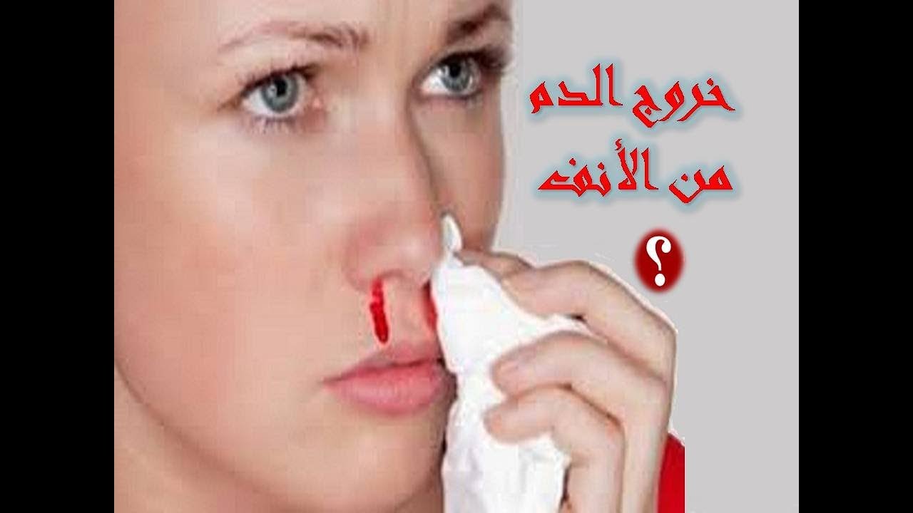 نزول الدم من الانف - اسباب وجود من الانف