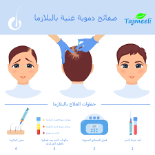 فوائد حقن البلازما للشعر , معلومات عن اهمية البلازما