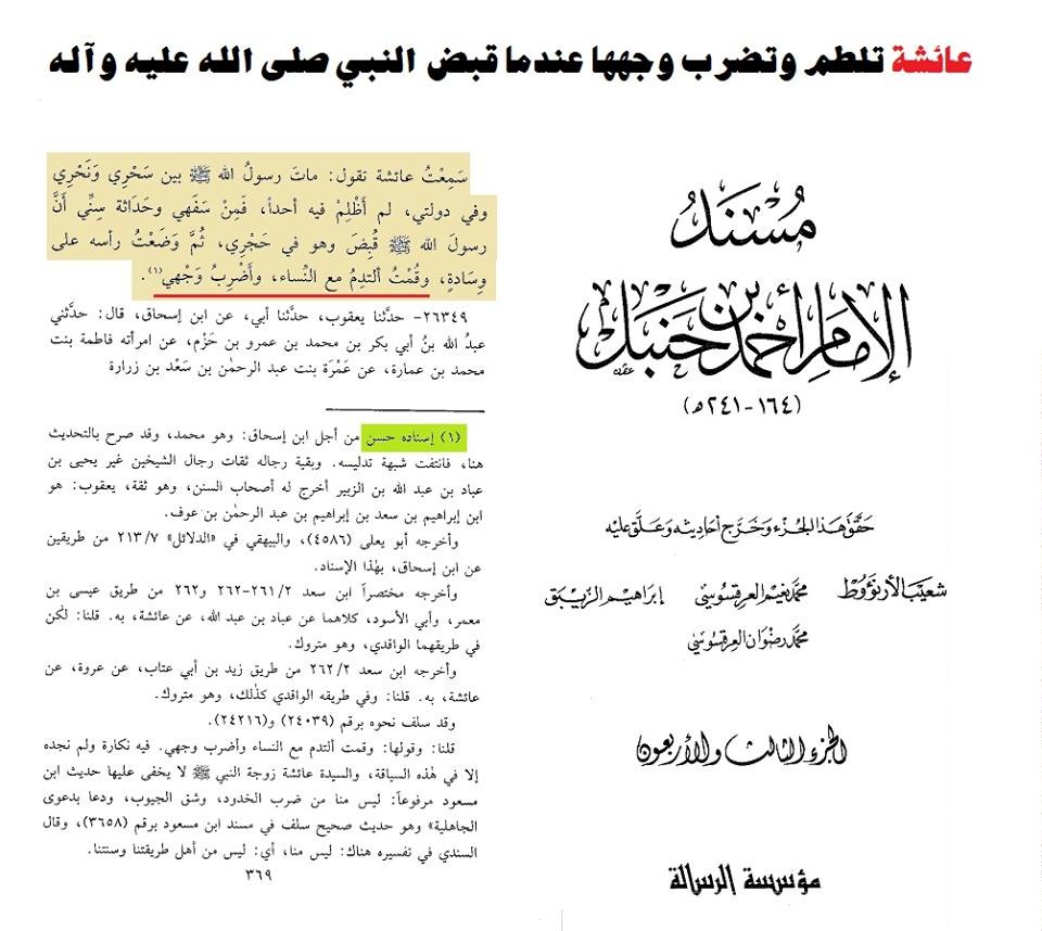 الحالة التي يصاب بها الانسان بالسهر وعدم القدرة على النوم - السهر من اكثر الاشياء ضررا للانسان 1122 10