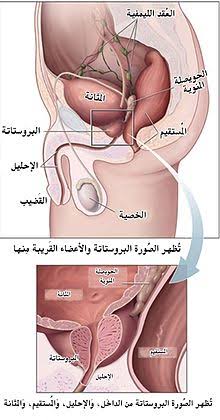 حجم البروستاتا 50 - علاجات تضخم البروستاتا 361 1