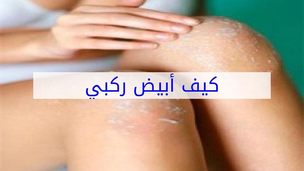 كيف ابيض ركبي , تفتيح الركبتين بطريقة بسيطة للسيدات