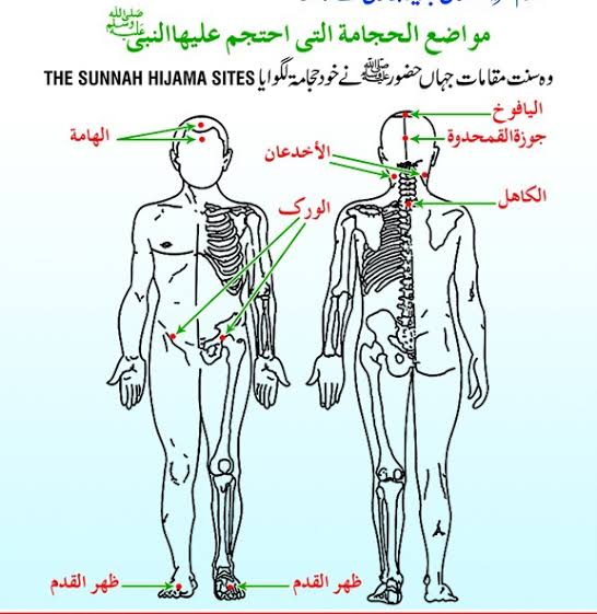 اماكن الحجامة للنساء - اين يمكن عمل الحجامه الي السيدات 481 2