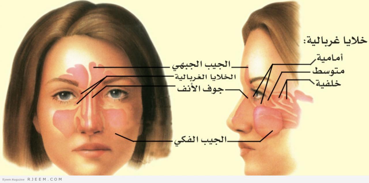 لماذا ينتج ألم الرأس , اسباب الم الراس