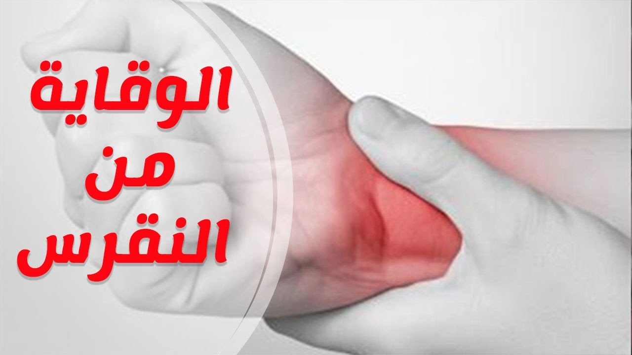 اسباب مرض النقرس - اعراض الاصابة بالنقرس 2954 2