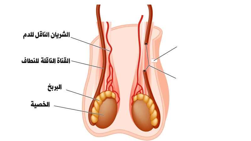 اسباب وجع الخصية , سبب الم الخصيه المفاجا