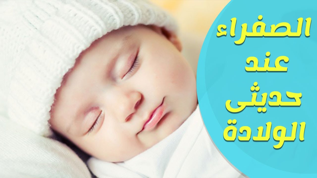 علاج الصفار عند الاطفال - طرق صحيحة لعلاج الصفراء 3054 3