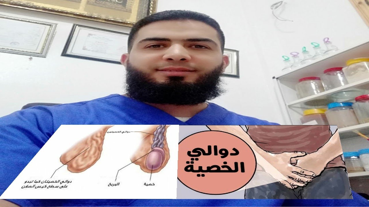 علاج دوالي الخصية بالطب النبوي ،وصفات للتخلص من دوالي الخصيه بالطب النبوي 2397 3