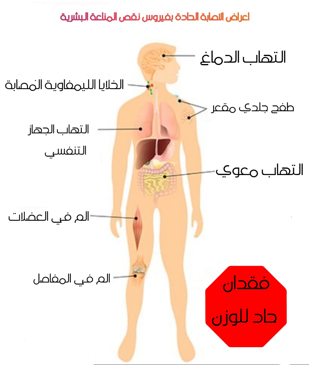 اعراض ضعف المناعة علامات اصابه الانسان بضعف مناعته احلى حلوات