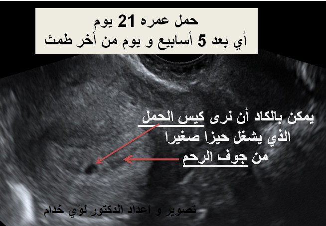 متى يظهر الجنين في كيس الحمل في اي اسبوع عالم حواء